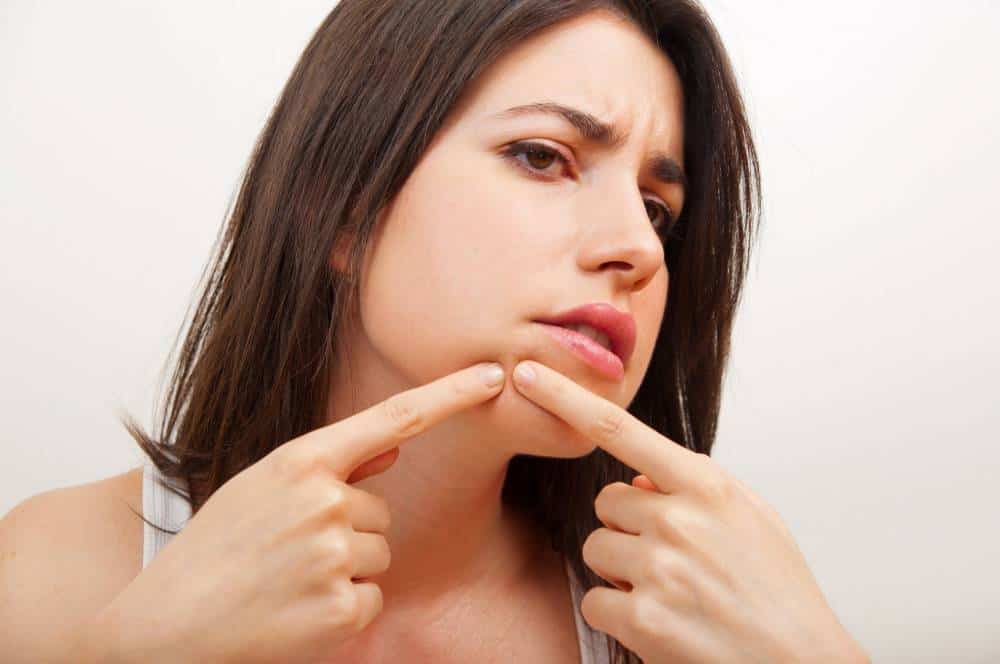 A woman popping acne.